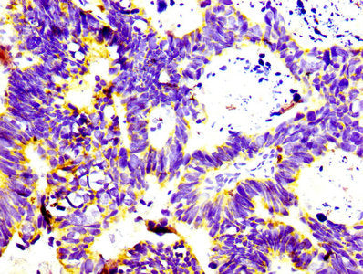 CD74 Recombinant Monoclonal Antibody