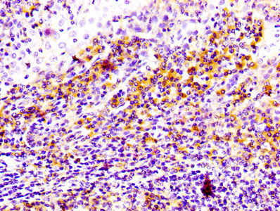 CD81 Antibody