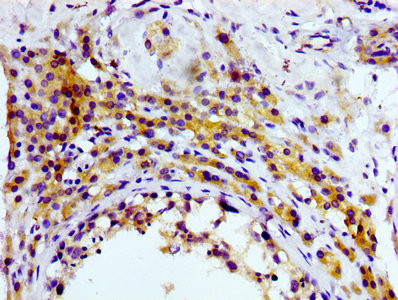 CD81 Antibody