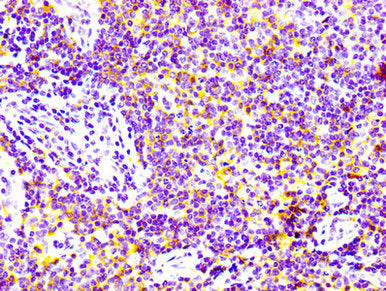 CD97 Recombinant Monoclonal Antibody