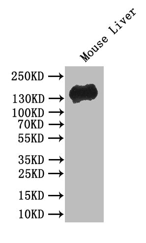 CDH1 Recombinant Monoclonal Antibody