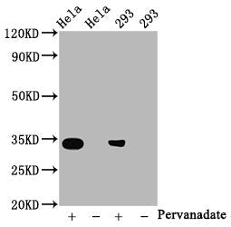 Phospho-CDK2 (Y15) Recombinant Monoclonal Antibody