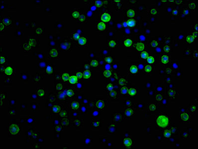 CD21 Antibody