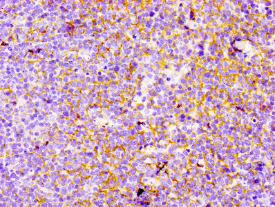 CD21 Antibody