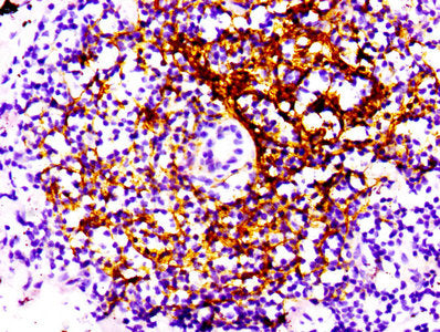 CD21 Antibody