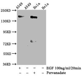 Phospho-EGFR (Y1092) Antibody