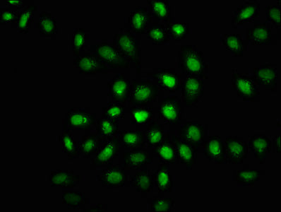 Phospho-EIF2AK2 (T446) Antibody