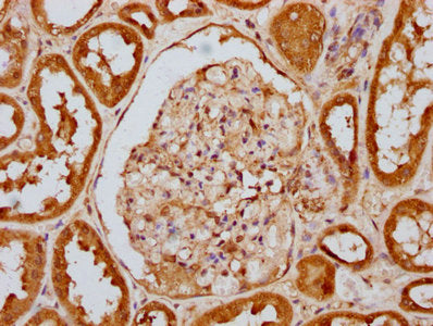 Phospho-EIF2AK2 (T446) Antibody