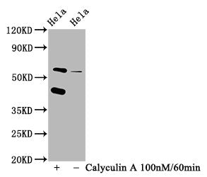 Phospho-EIF2AK2 (T446) Recombinant Monoclonal Antibody