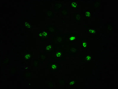 Phospho-EIF2S1 (S51) Antibody