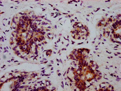 Phospho-EIF2S1 (S51) Antibody