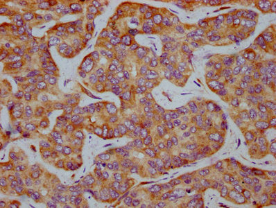 Phospho-EIF2S1 (S51) Antibody