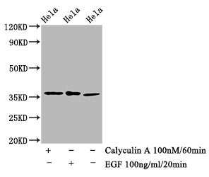 Phospho-EIF2S1 (S51) Recombinant Monoclonal Antibody