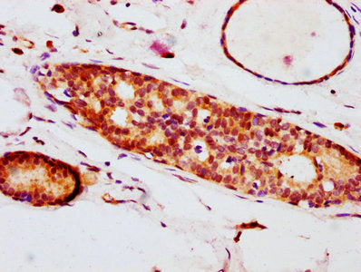 Phospho-EIF4E (S209) Antibody