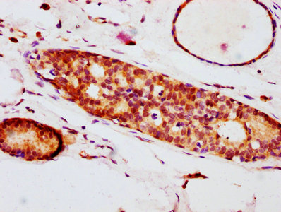 Phospho-EIF4E (S209) Antibody