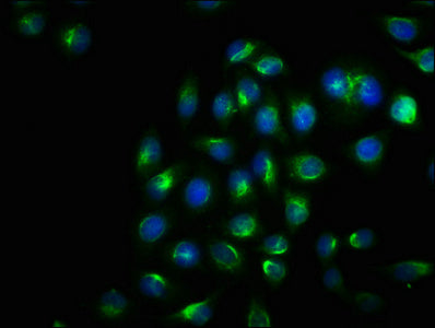 Phospho-ERN1 (S724) Antibody