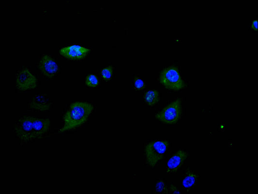 FCGR3A Recombinant Monoclonal Antibody