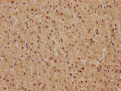 FOS Antibody