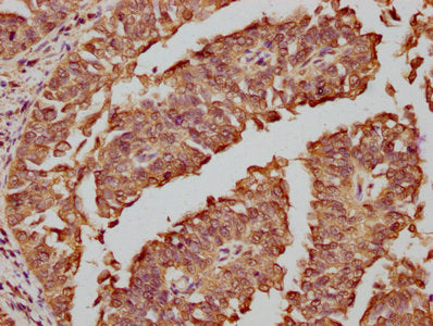 FOS Antibody