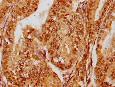 FOXO3 Antibody