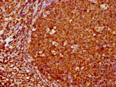 FOXO3 Antibody