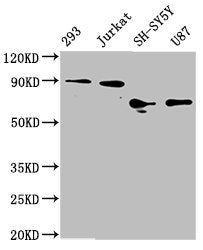 FOXO3 Recombinant Monoclonal Antibody