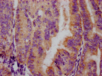 Phospho-FOXO3 (S253) Antibody