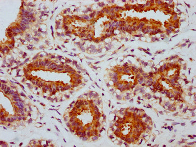 Phospho-MTOR (S2448) Antibody