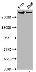 Phospho-MTOR (S2448) Antibody
