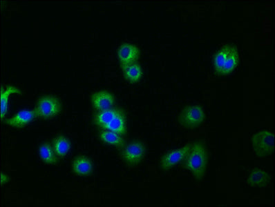 GPC3 Antibody
