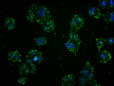 GSTO1 Antibody