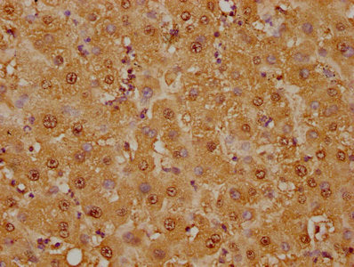 GSTO1 Antibody