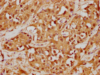 GSTO1 Antibody