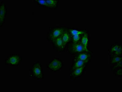 Phospho-GYS1 (S641) Antibody