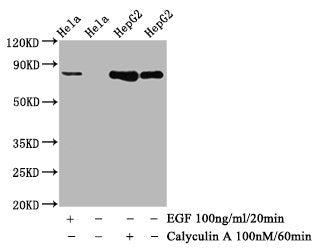 Phospho-GYS1 (S641) Recombinant Monoclonal Antibody