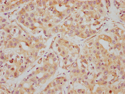 HDAC6 Antibody