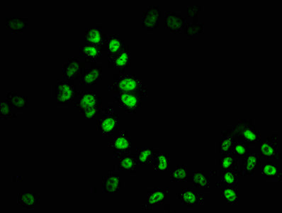 HDAC9 Antibody