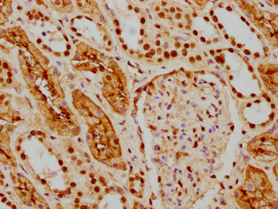 HDAC9 Antibody