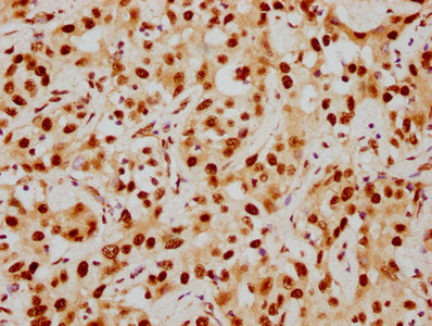 HDAC9 Antibody