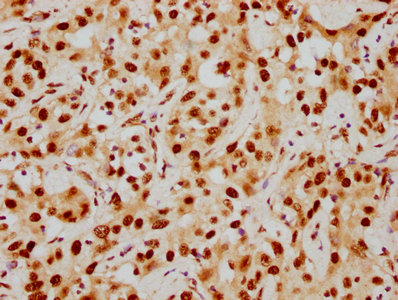 HDAC9 Antibody