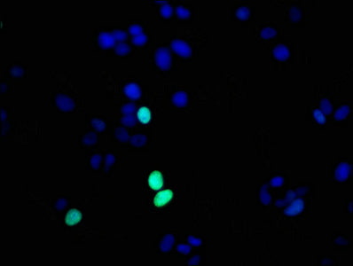 Phospho-Histone H1.4 (T17) Antibody
