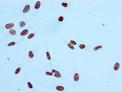 Acetyl-Histone H2A type 1-B/E (K9) Antibody