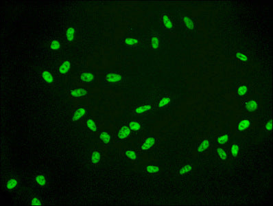 Acetyl-Histone H2A type 1-B/E (K9) Antibody