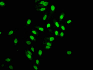 Histone H2A type 1-B/E Antibody