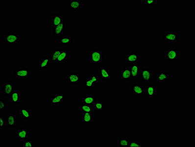 Acetyl-Histone H2B type 1-B（K20）Antibody