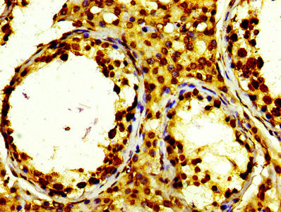 Histone H2B type 1-K Antibody