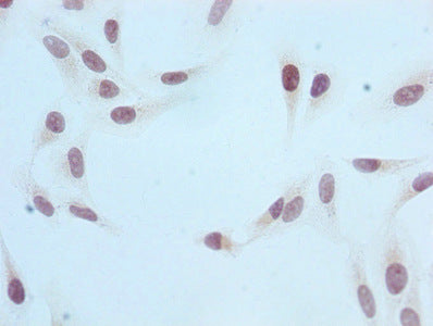 Mono-methyl-Histone H3.1（R2）Antibody