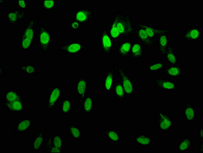 Mono-methyl-Histone H3.1（R2）Antibody