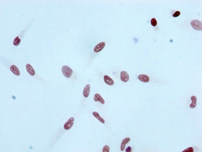 Acetyl-Histone H3.1（K4）Antibody