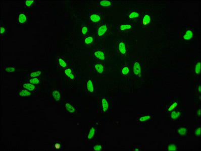 Acetyl-Histone H3.1（K4）Antibody